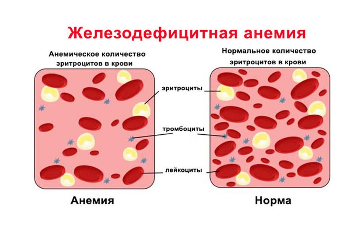Кускус железо кровь анемия