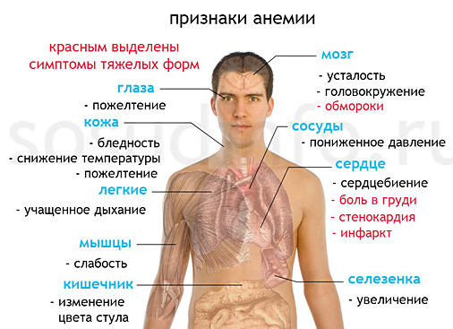 анемия у детей симптомы бледность слабость